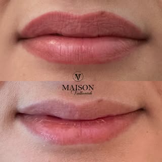 UN RÉSULTAT QUI CHANGE TOUT !
Découvrez ce résultat de maquillage permanent des lèvres après cicatri