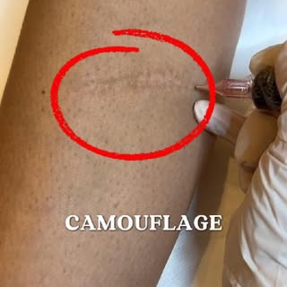 Je réponds souvent à la question : «  Est - ce que vous travaillez avec la peau foncée ? «  

Ma rép