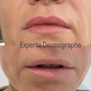 La beauté ne devrait jamais masquer votre personnalité. Elle devrait simplement la révéler.

Sur cet