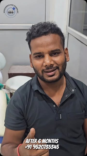 ✨ 6 Months. A Visible Transformation.

A journey from hair loss to a fuller, natural-looking appeara