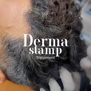 Using Hair Serum but not seeing results? 🤔

A Derma Stamp can help by creating tiny micro-channels 