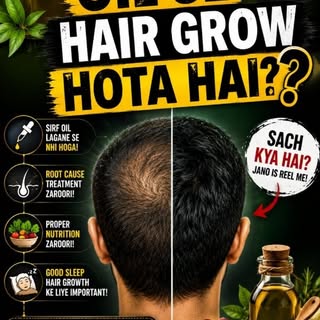 🚨 Har Hair Fall normal nahi hota!

Roz 50–100 baal girna aam baat ho sakti hai. Lekin agar hairline