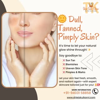 ✨ Tired of Dull, Tanned, and Blemished Skin? Here’s How to Get Back Your Radiant Glow! 🌞
🌿 Healthy
