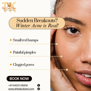 🔥 Sudden Breakouts? Winter Acne Is Real! ❄️😓

Nashik’s winter may feel amazing, but your skin migh