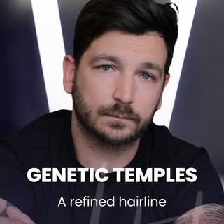 Not every hair transplant begins with severe hair loss.

For Patrick, it wasn’t about covering baldn