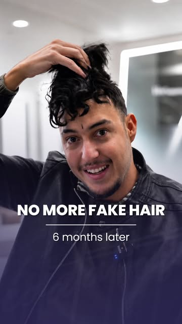 For a long time, taking off the hairpiece meant revealing what Barış wanted to hide.

Now it means s