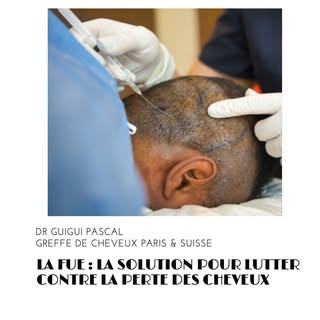 LA FUE : LA SOLUTION POUR LUTTER CONTRE LA PERTE DES CHEVEUX

La perte des cheveux, un problème renc