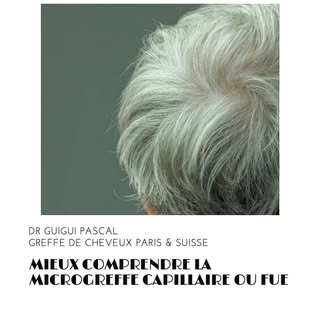 MIEUX COMPRENDRE LA MICROGREFFE CAPILLAIRE OU FUE

La microgreffe capillaire ou FUE (Follicular Unit