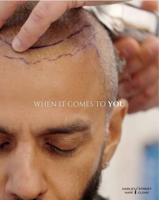 One thing we’ll never do is promise the impossible.

Hair restoration is a medical field, not a magi