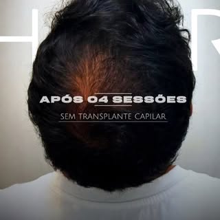 Cuidar do couro cabeludo é o primeiro passo para ter fios fortes e cheios de vida ✨
Aqui na Clínica 