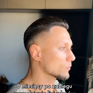 Dziękuję za współpracę @sharley_hair_clinic 
Ładnie to wyszło ✨

#współpraca