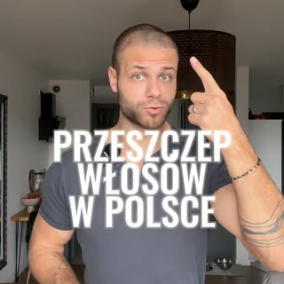 Zrobiłem przeszczep włosów w Polsce. Jak wyglada zabieg i ile kosztuje? Wszystkiegondowiesz sie z te
