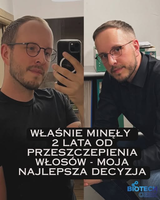 Zawsze mówiłem, że najlepsze co mi w życiu wyszło to włosy. Teraz po dwóch latach, nadal mam duże cz