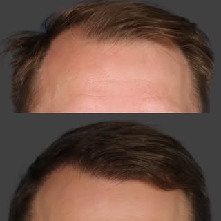 At L&P, we’re known for our signature deep plane facelift—but today, we’re turning the spotlight on 
