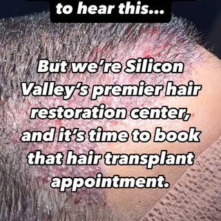 You might not want to hear this, but we’re Silicon Valley’s premier hair restoration center, and it’