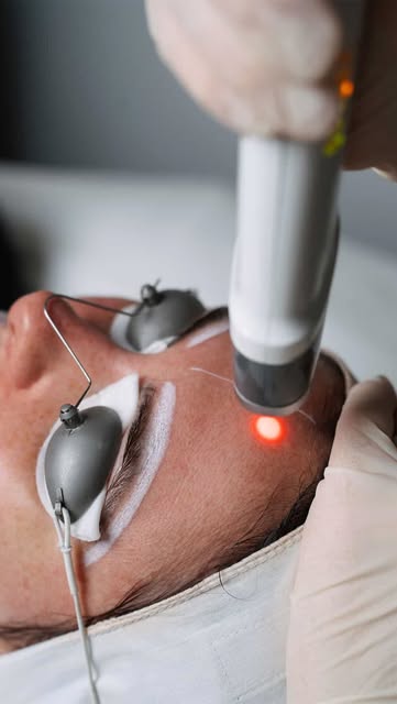 Stubborn pigmentation that skincare just won’t fade? ✨

Pico Laser uses targeted laser technology to