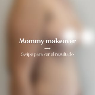 El paso del tiempo y la maternidad transforman tu cuerpo de manera natural. Sin embargo, es completa