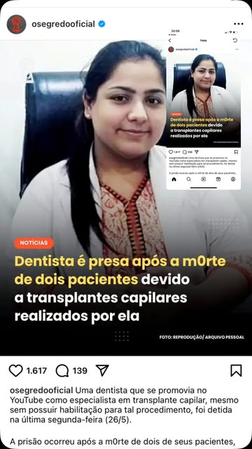 E você, teria coragem de fazer TC comigo m qualquer lugar? #transplantecapilarfue #alopecia #dermato