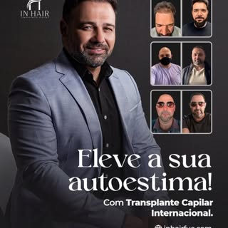 Chega de calvície, chega de bonés. Tenha sua  autoestima e confiança restaurada! 🥰🇺🇸#transplantec