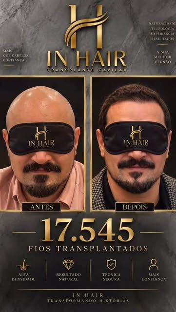 Parece mágica, mas é real. Determinação, foco, técnicas e muito amor naquilo que fazemos. InHair as 