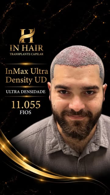 Com certeza valeu deslocar 700 Km para realizar sua transformação conosco ! Fenomenal ! InHair os me