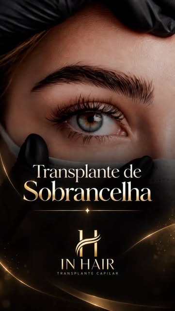 ✨ TRANSPLANTE DE SOBRANCELHA | INHAIR

Sobrancelhas mais preenchidas, definidas e com aspecto natura