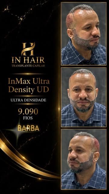 Mais uma transformação com a excelência InHair ! Parabéns ao nosso querido cliente. InHair as melhor