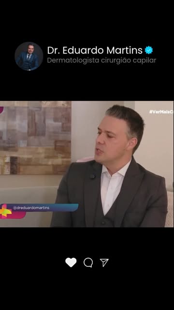 Transplante capilar também pode utilizar pelos corporais em casos selecionados. 

Quando a área doad