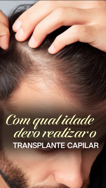 Não existe idade certa para fazer o transplante capilar.

O momento certo é quando a calvície começa