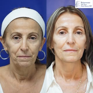 Sonia is one of the toughest ladies I know! 💪 She came to us looking for a refresh, wanting to look