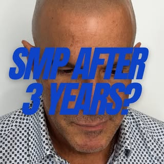This is what SMP should look like after 3 years.

Soft. Natural. Undetectable. The kind of result th