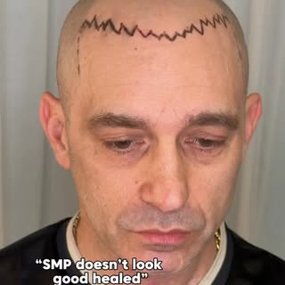 SMP looks good healed when you pick the right artist.

That’s it. Simply bringing back the frame to 
