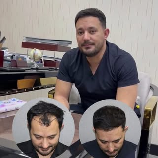 Özgüvənini yenidən qazanmağa hazırsansa, ilk addımı bu gün at.

Saç tökülməsi bəzən sadəcə görünüş m