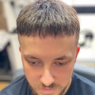 #hairunit #hairsystem #hairpeice #toupee  #hairlosssolutions #bald #nonsurgical #painfree #lookgoodf