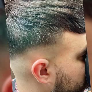 #hairunit #hairsystem #hairpeice #toupee  #hairlosssolutions #bald #nonsurgical #painfree #lookgoodf