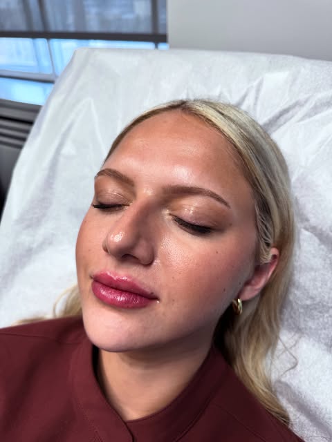 One of my favorite lip enhancements lately 🤍
It was an honor to help get my friend & colleague get 