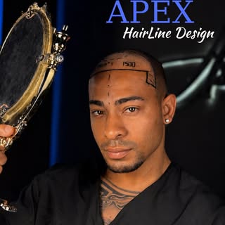 Apex Hairline Design — where a natural look begins. ✨

Every face has unique proportions, forehead s