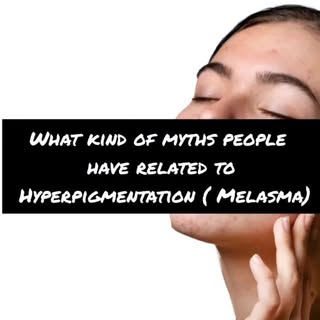Melasma is often surrounded by several myths and misconceptions. Here are some common ones:

Only Wo