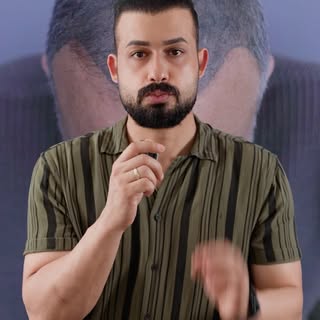 Pepe’nin babasına benzetiyorlardı.

Ön hatlarının doğal olmaması sebebiyle cizgifilm karakterine ben