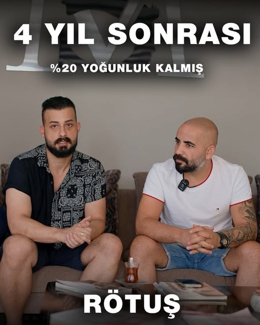 İŞLEMİMİZ 4 YIL SONRA GERİ DÖNDÜ…

4 yıl önce bizi saç simülasyonu ile ziyaret eden danışanımızın, b