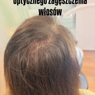 Naturalny pigment, trwałość i spektakularny efekt zagęszczenia włosów metodą mikropigmentacji! #nowo