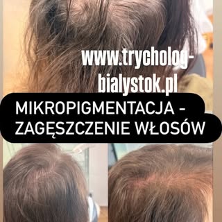 Zagęszczenie optyczne włosów to bezbolesne rozwiązanie#trychologia #podlasie #wypadaniewłosów #zagęs