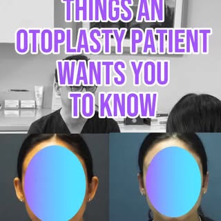 Top 5 Otoplasty Patient Secrets! 💜👂

Ever wondered what it’s really like to have Otoplasty? We’re 