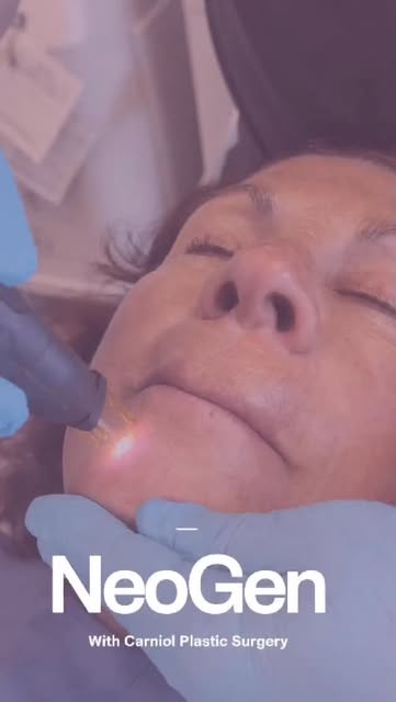 ✨ Full-Face Skin Rejuvenation? YES, PLEASE! ✨

Watch the power of nitrogen plasma hard at work. ⚡️ T