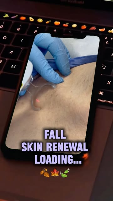 CO₂ laser resurfacing that YOU need!! ⭐️

As the leaves start to change and autumn approaches, it’s 