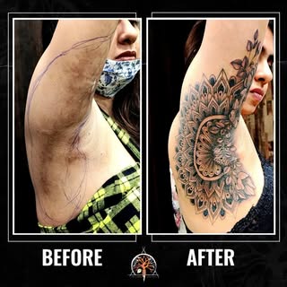 Adorn your scars your way! With Inkinn tattoo artist, get a scar cover-up having exclusive design & 
