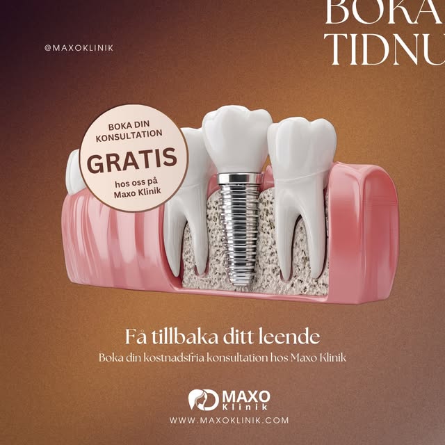 En saknad tand behöver inte betyda ett saknat leende.

Med tandimplantat kan vi återskapa både funkt