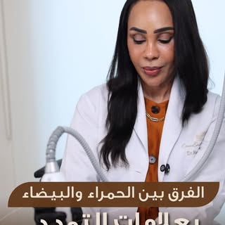 ⁨	⁨	كلما تحولت علامات التمدد إلى اللون الأبيض… أصبحت أكثر تحديًا في العلاج.

لكن هذا لا يعني أنه لا 