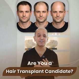 Hair loss doesn’t automatically mean you need a transplant.

The right candidate depends on your hai