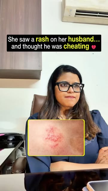 She noticed a rash on her husband and immediately thought, “Is he cheating on me?”

But here’s the i